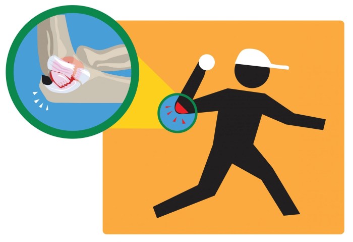 What Tommy John Surgery Entails | Dr. Andrachuk, Atlanta Orthopedist Mets dedniel nunez could be headed for tommy john