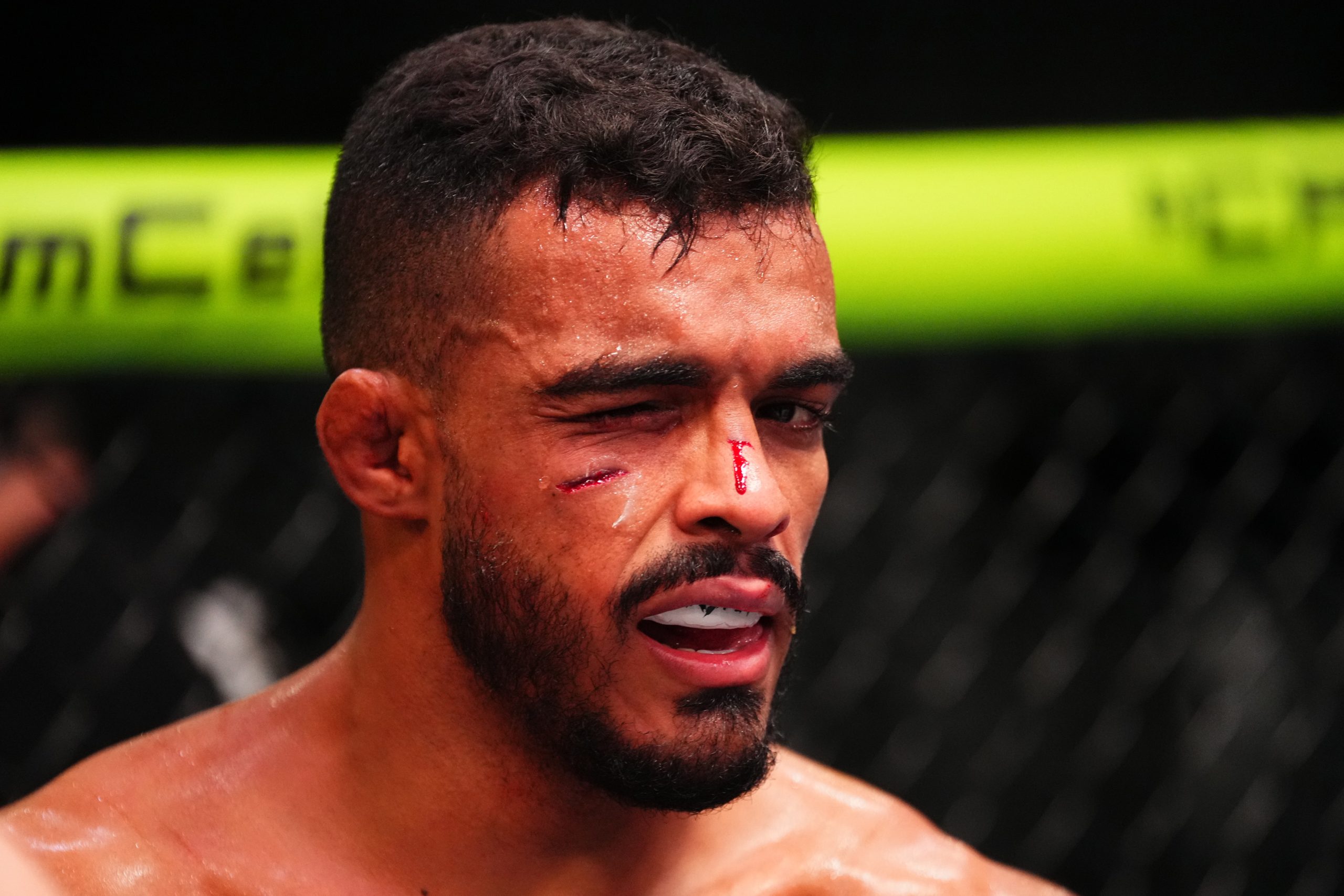 Ismael Bonfim Recounts Four-Day Vision Loss Post-Orbital Fracture, Supports Tom Aspinall’s Stance on UFC 321 Eye Injury Stoppage