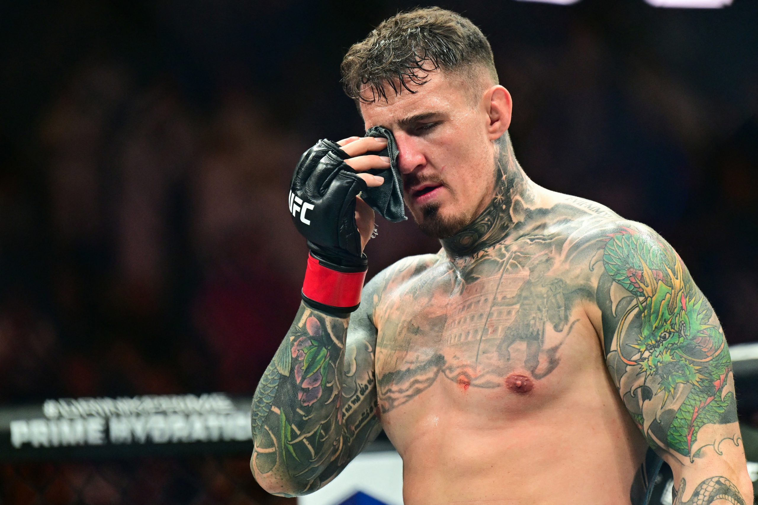 UFC President Dana White Clarifies Stance on Tom Aspinall’s Eye Injury, Denies Derogatory Remarks.