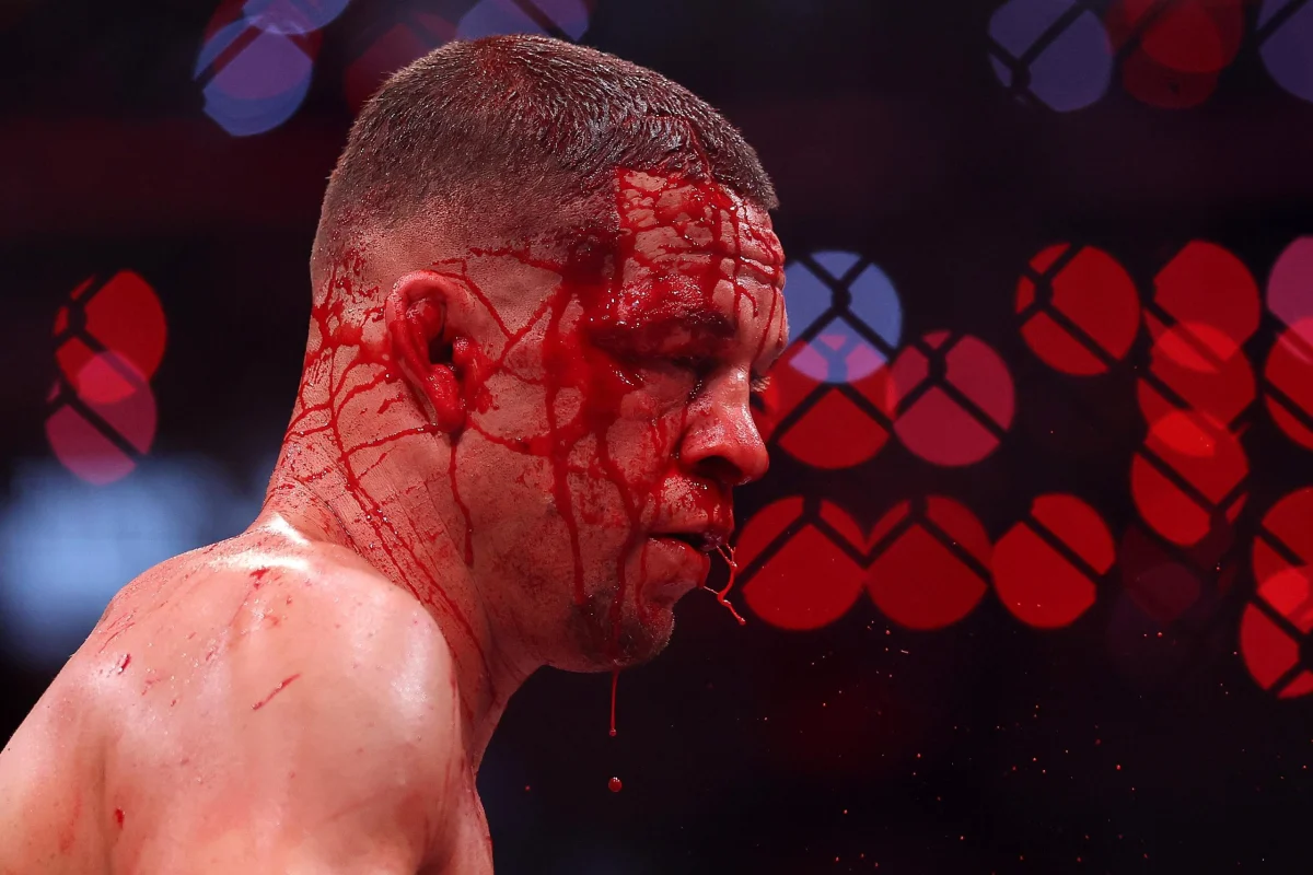 Diaz Declares "Time to Kill" Following Stoppage Loss to Perry at Netflix Slam