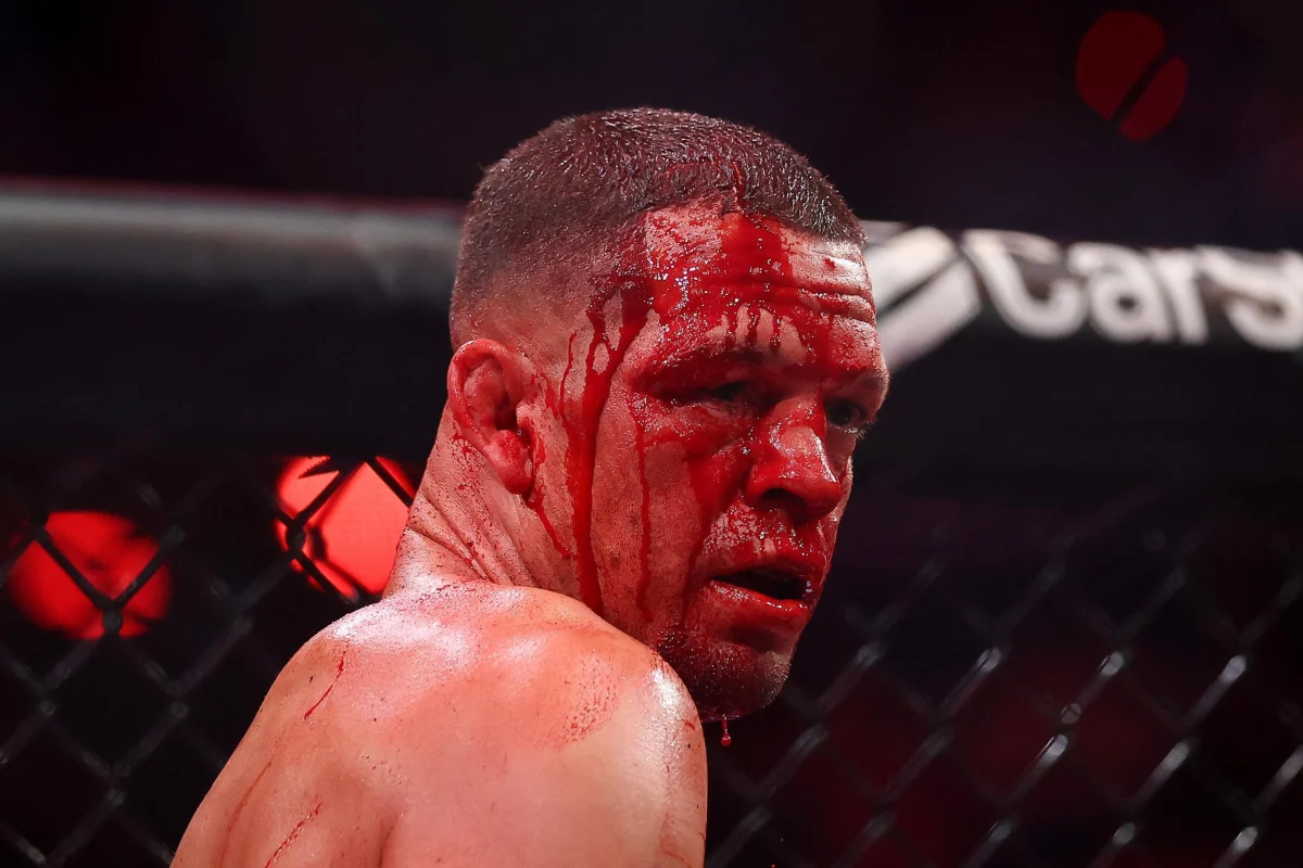 Diaz Defies Retirement Calls After Mike Perry Stoppage, Vows Continued Combat Journey