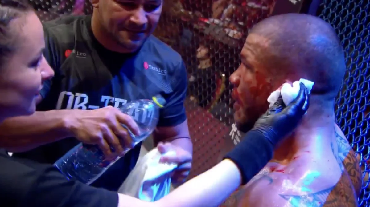 Valmir da Silva’s Bout Halted Due to Severe Cauliflower Ear Rupture at North West Power Alliance Event